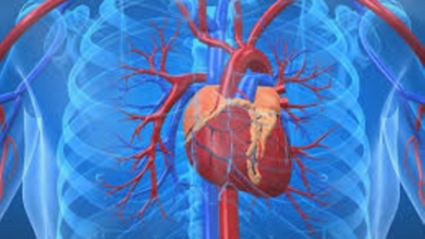 Coronary Calcium Score
